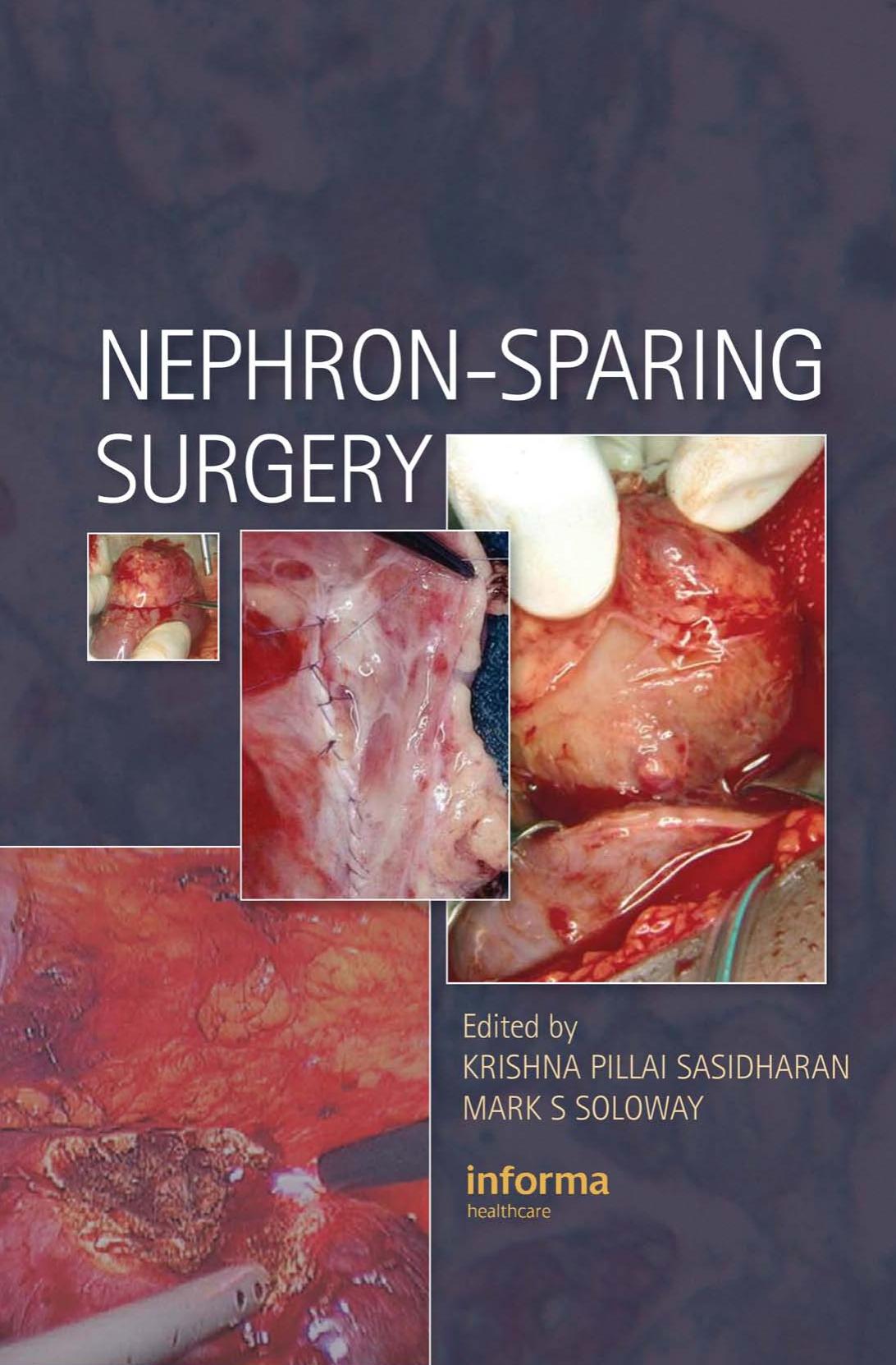 Nephron-Sparing Surgery by K. Sasidharan Mark Soloway
