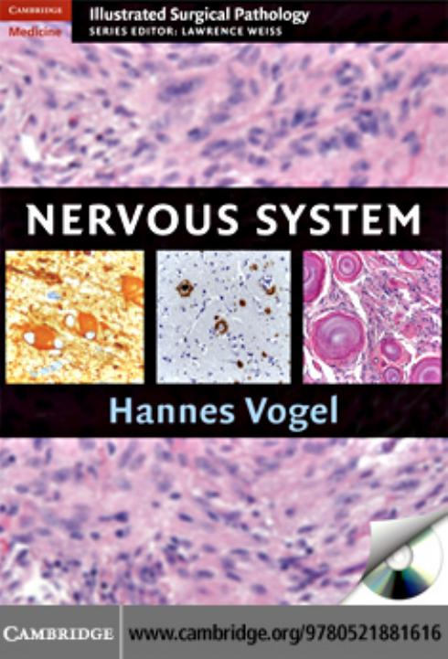 Nervous System (Cambridge Illustrated Surgical Pathology) by Hannes Vogel MD