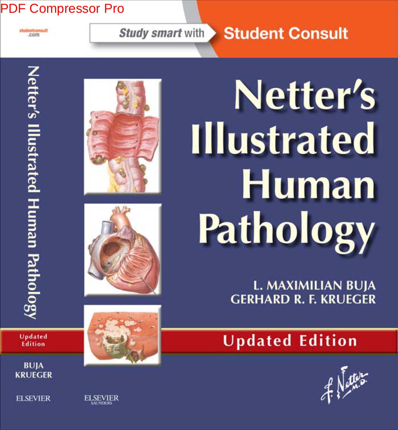 Netter's Illustrated Human Pathology by Buja M. Krueger G