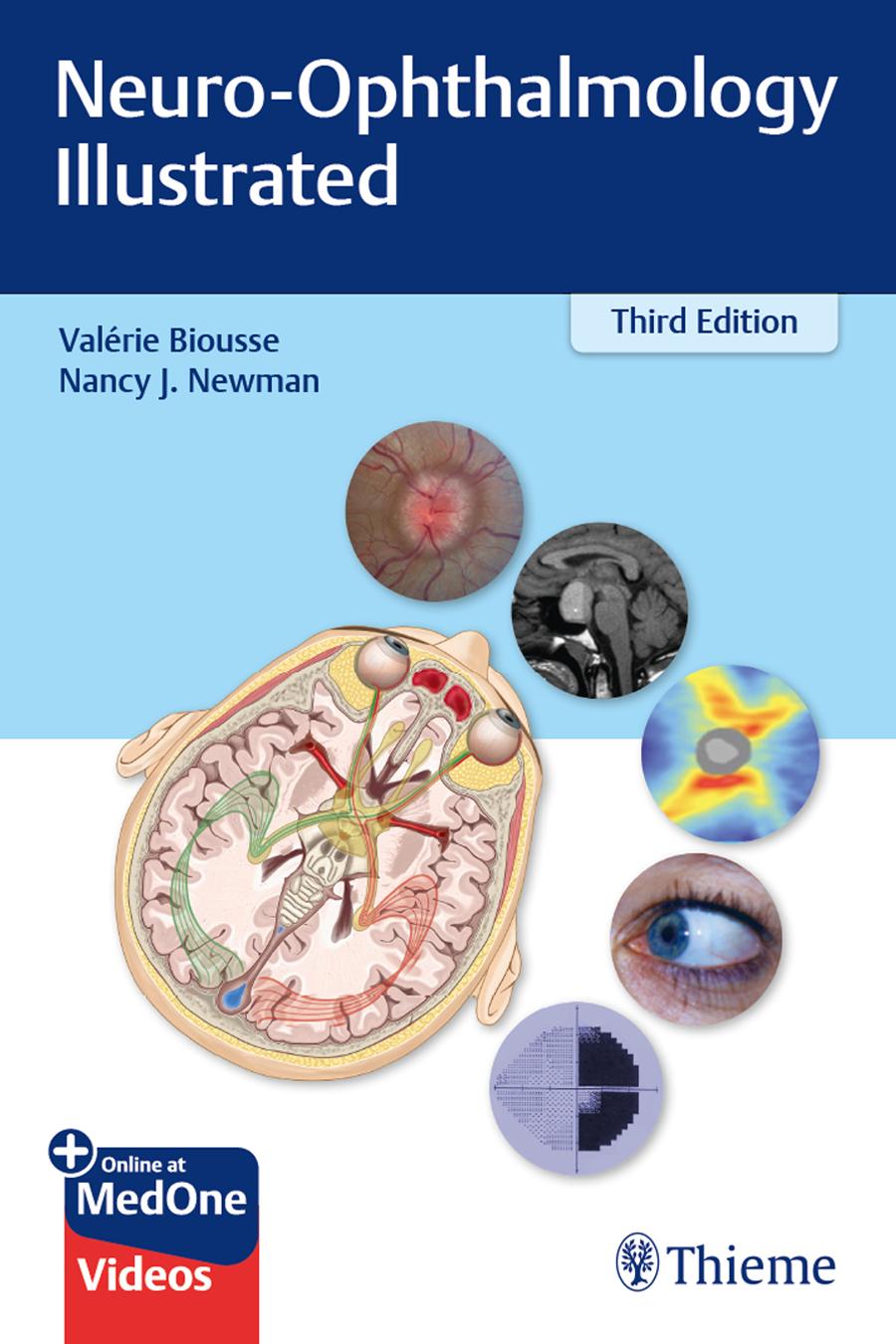Neuro-Ophthalmology Illustrated by Valerie Biousse Nancy Newman