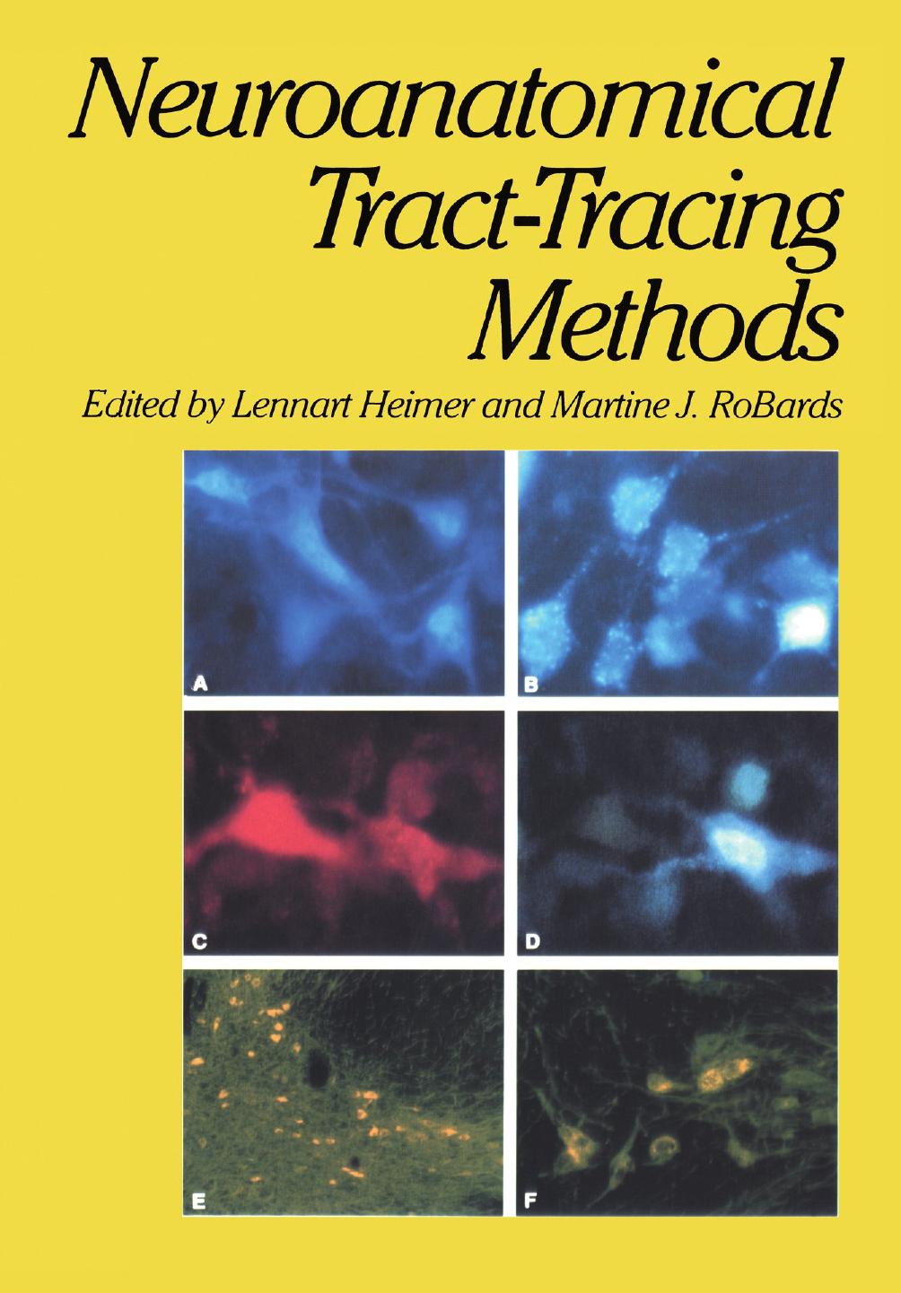 Neuroanatomical Tract-Tracing Methods by Theodore W. Blackstad Lennart Heimer (auth.) Lennart Heimer Martine J. Robards (eds.)
