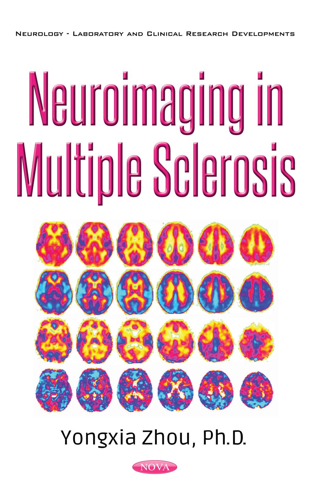 Neuroimaging in Multiple Sclerosis (Neurology-laboratory and Clinical Research Developments) by Ph.D. Zhou Yongxia
