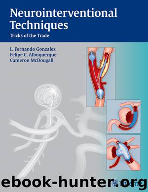 Neurointerventional Techniques by Gonzalez Fernando L.; Albuquerque Felipe C.; McDougall Cameron G