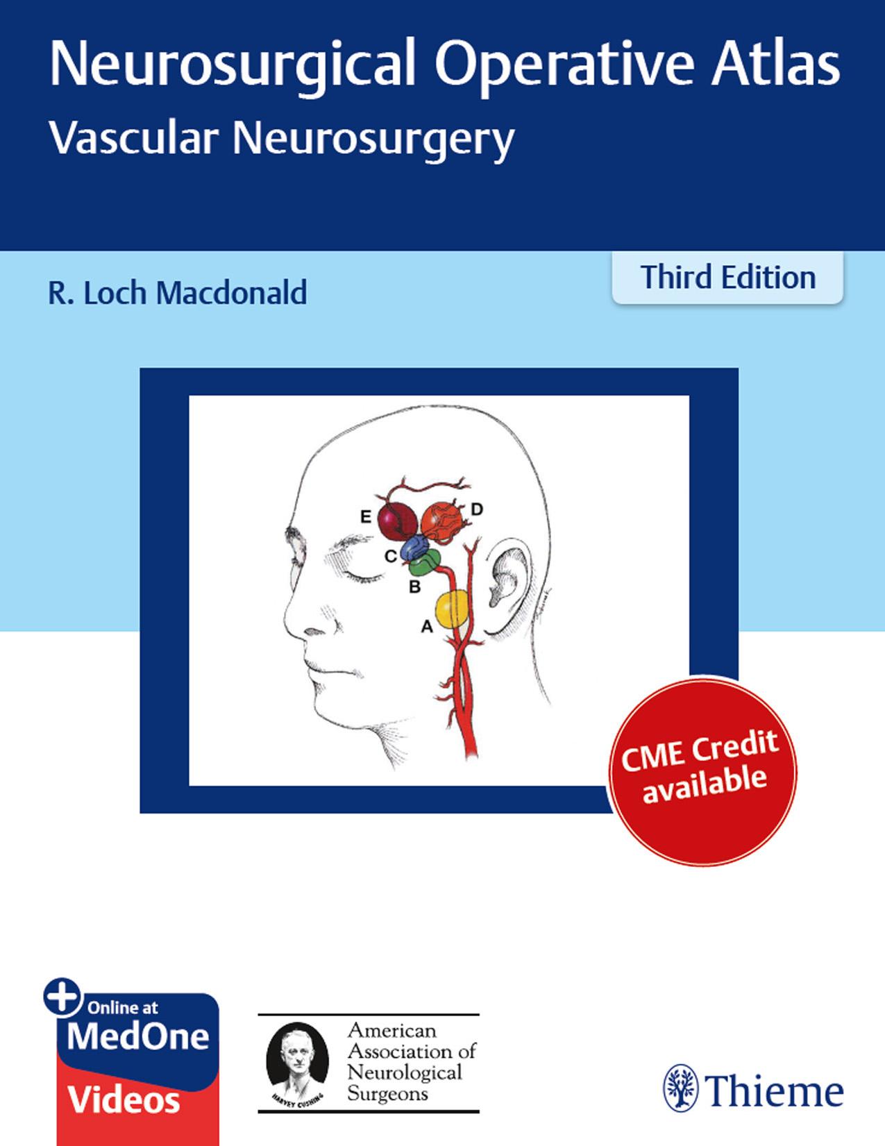 Neurosurgical operative atlas. Vascular neurosurgery by Robert Loch Macdonald (editor)