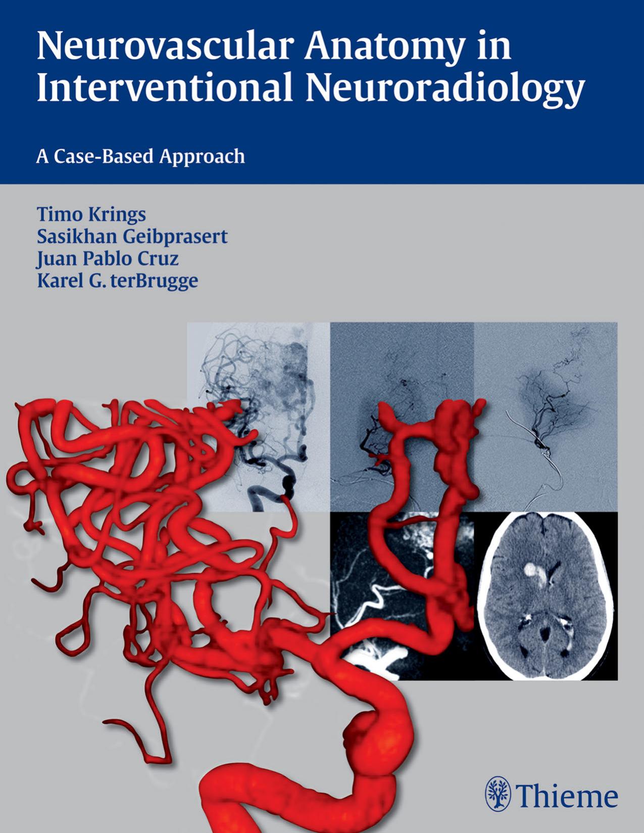 Neurovascular Anatomy in Interventional Neuroradiology: A Case-Based Approach by Unknow