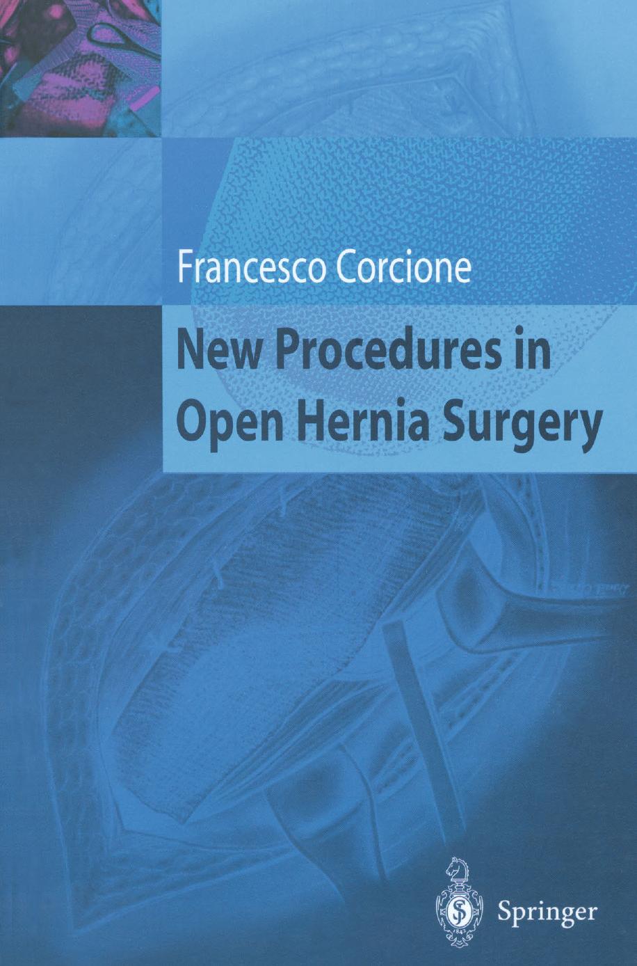 New Procedures in Open Hernia Surgery by Francesco Corcione (auth.)