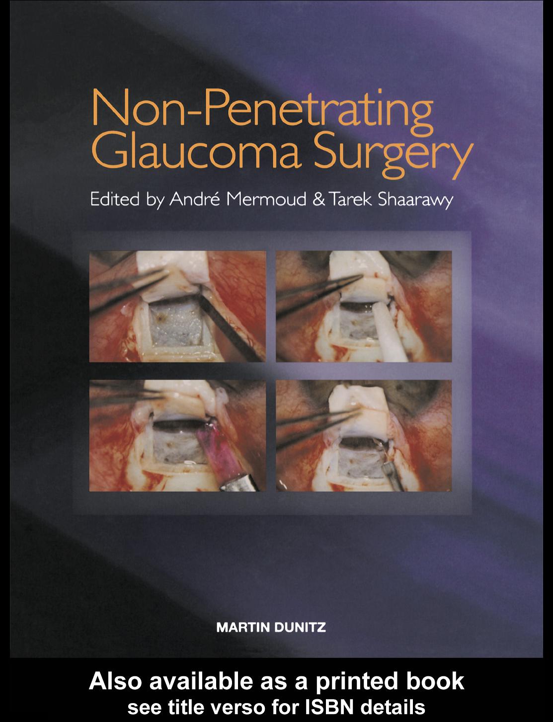 Non-Penetrating Glaucoma Surgery by Andre Mermoud Tarek Shaarawy