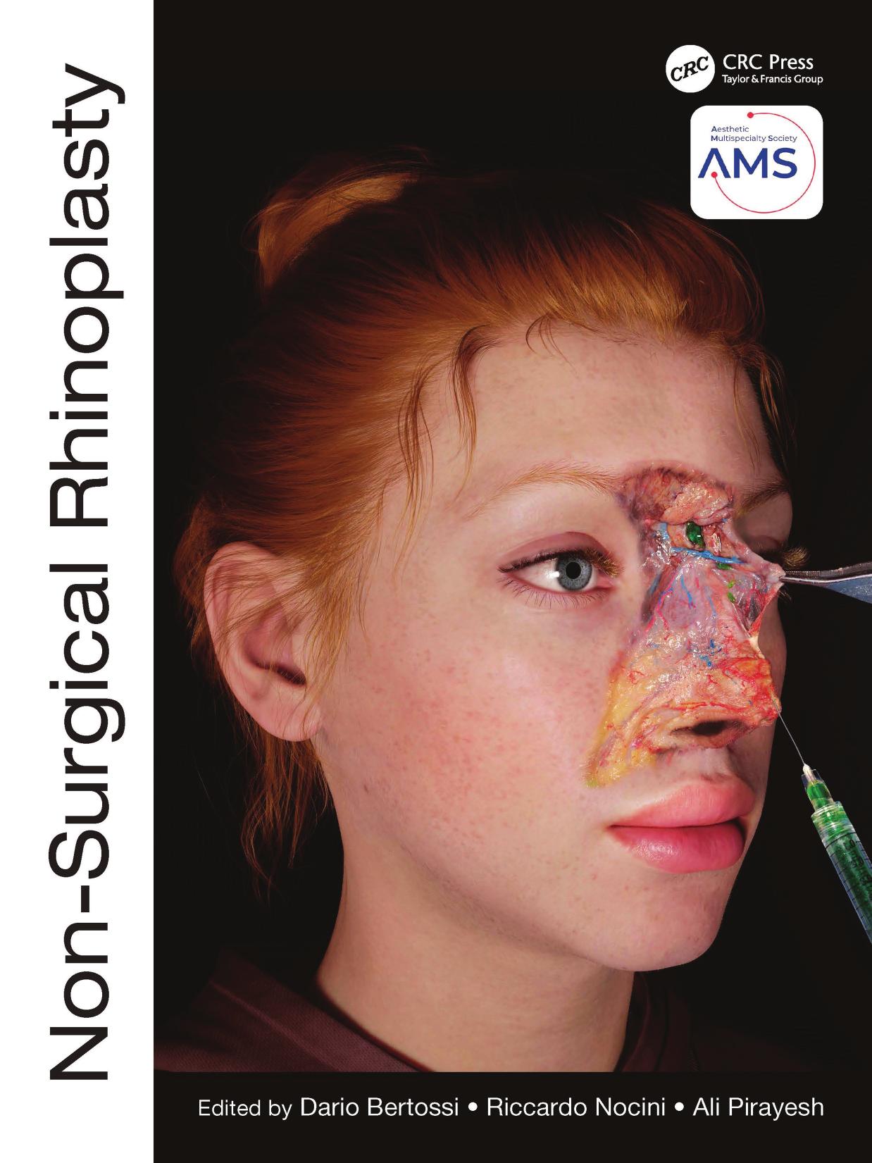 Non-Surgical Rhinoplasty, Riccardo Nocini, Ali Pirayesh by Dario Bertossi