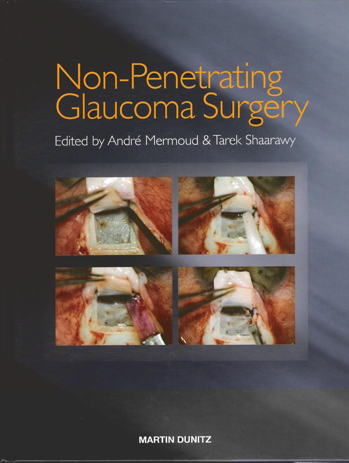 Non-penetrating glaucoma surgery by André Mermoud; Tarek Shaarawy