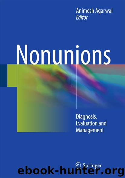 Nonunions by Animesh Agarwal