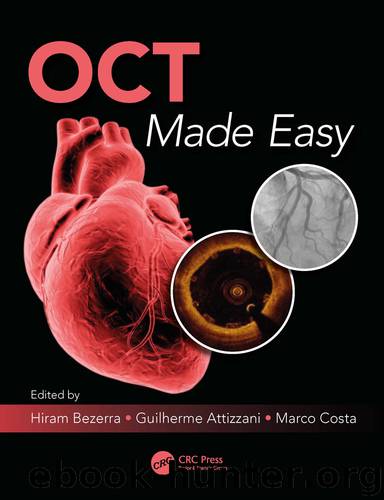 OCT Made Easy by Hiram G. Bezerra & Guilherme F. Attizzani & Marco A. Costa