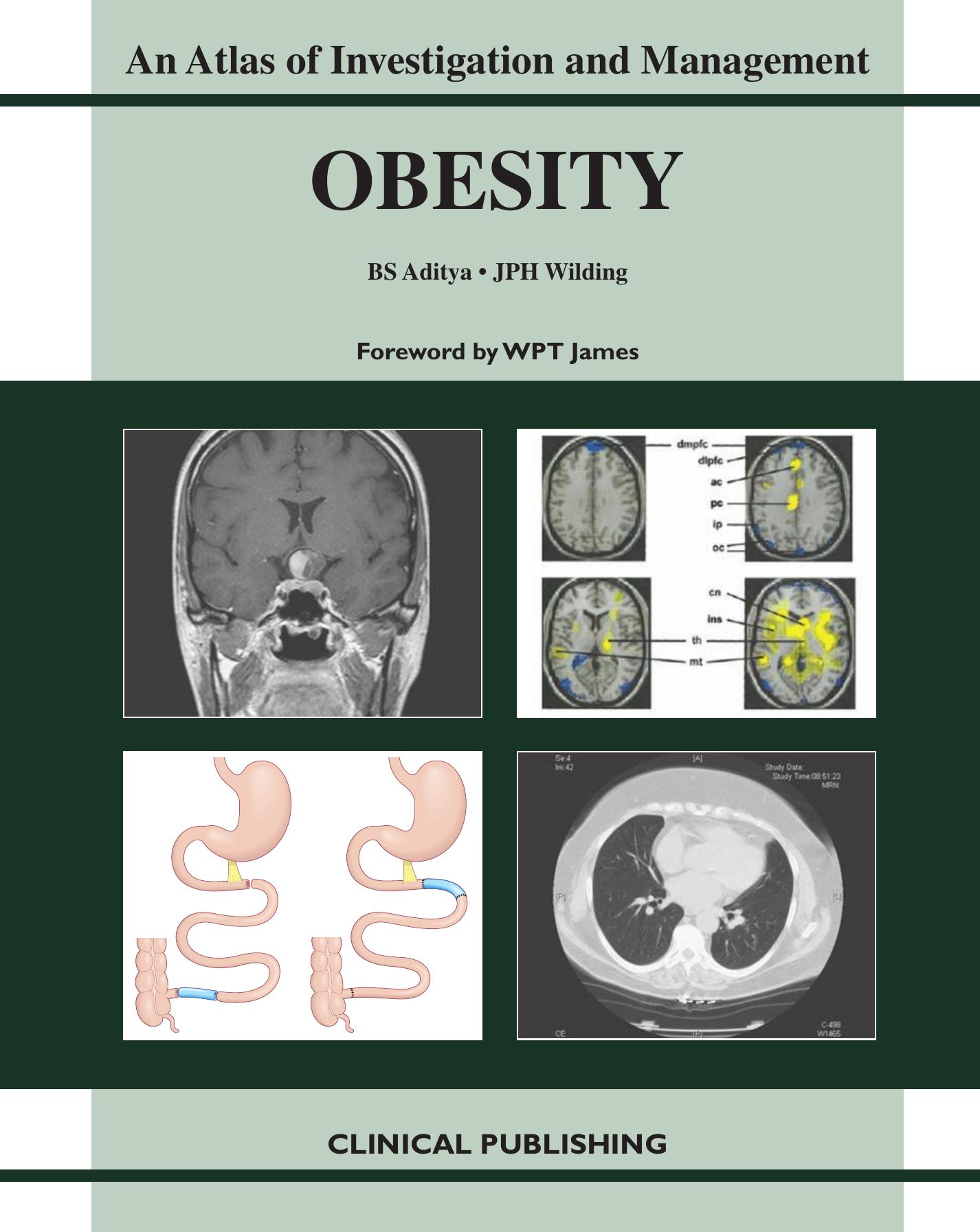 Obesity - An Atlas of Investigation and Management by BS Aditya JPH Wilding