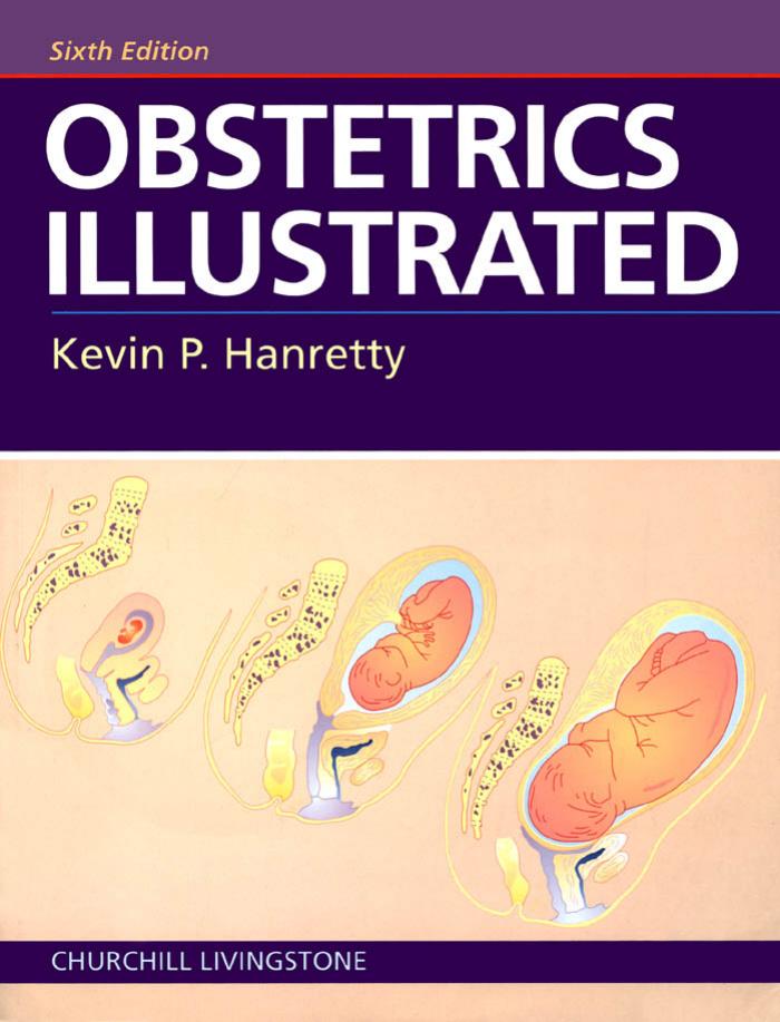 Obstetrics Illustrated by Kevin P. Hanretty MD FRCOG