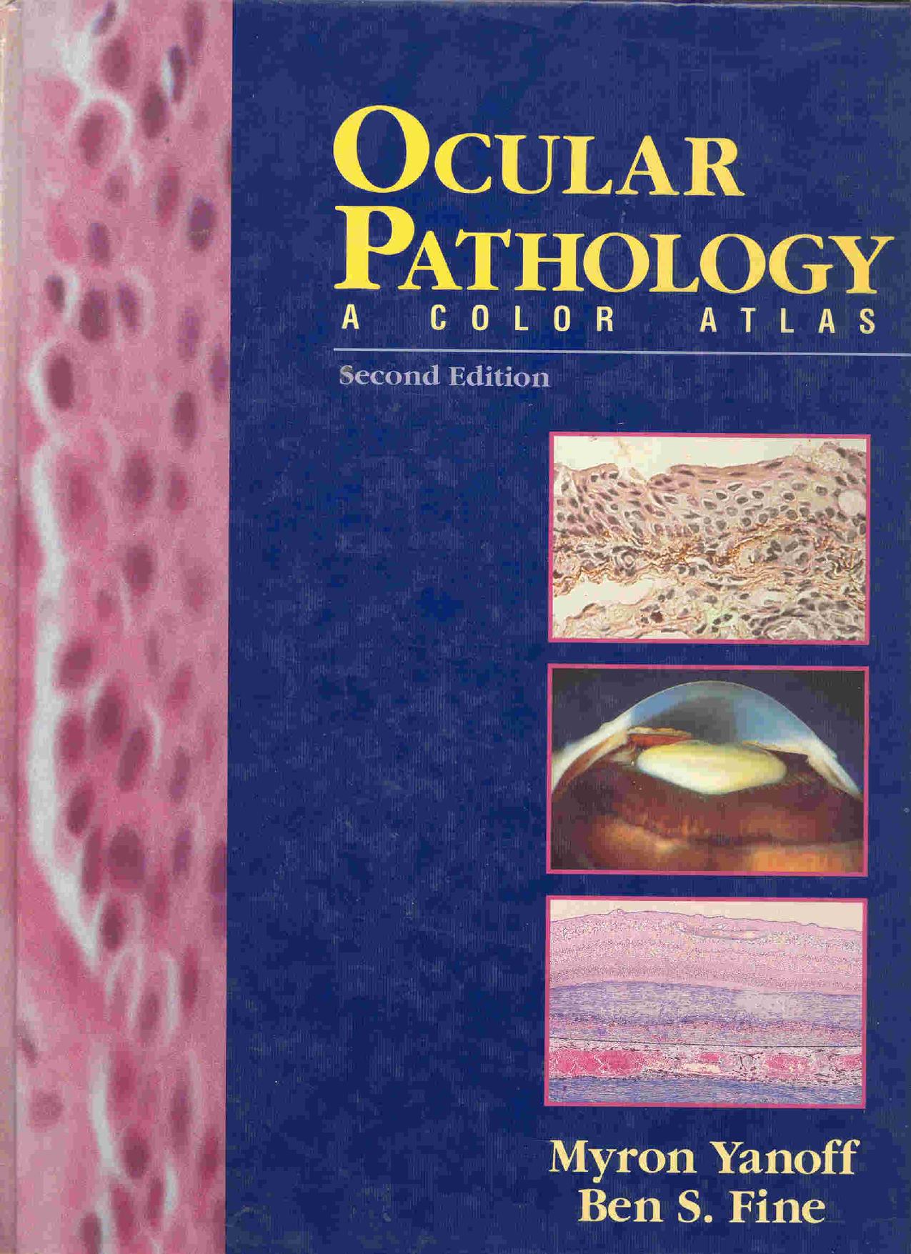 Ocular pathology : a color atlas by Myron Yanoff Ben S. Fine