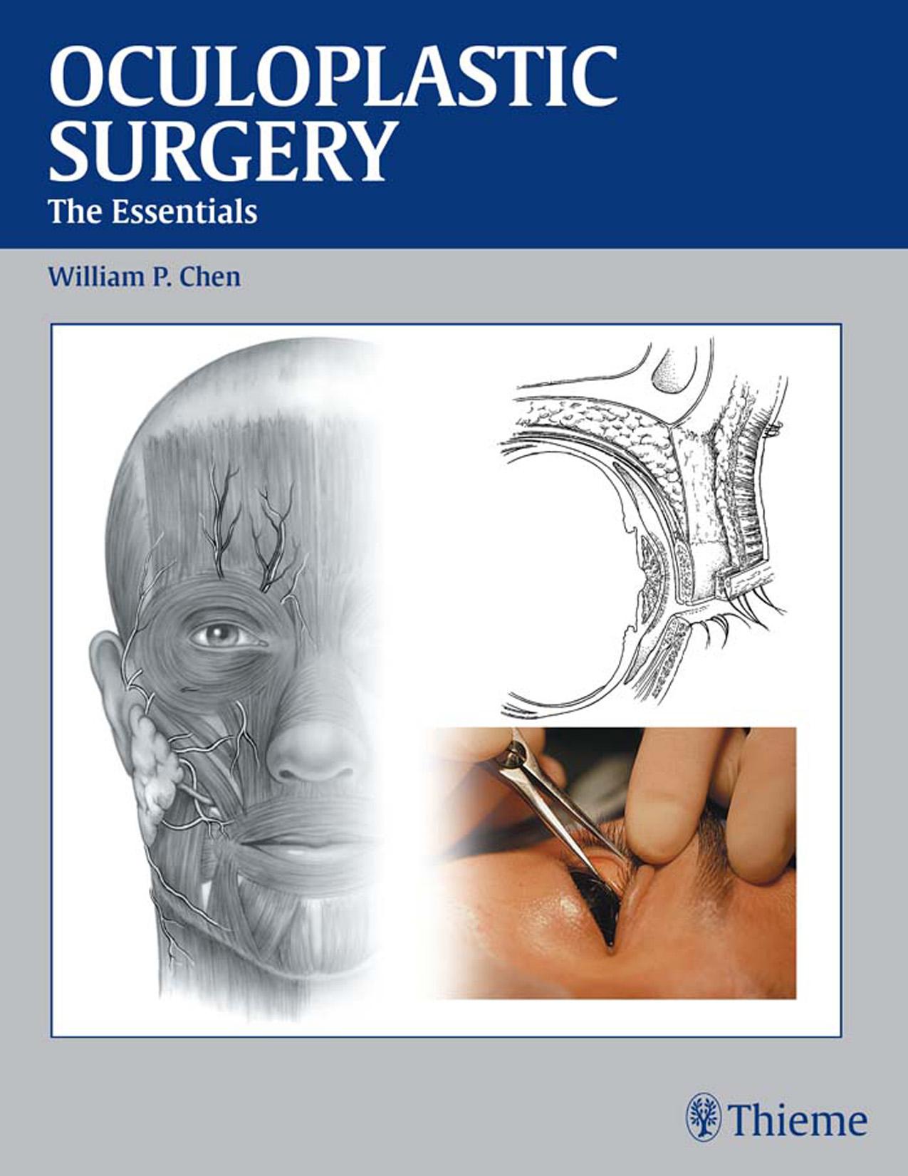Oculoplastic Surgery: The Essentials by William Pai-Dei Chen