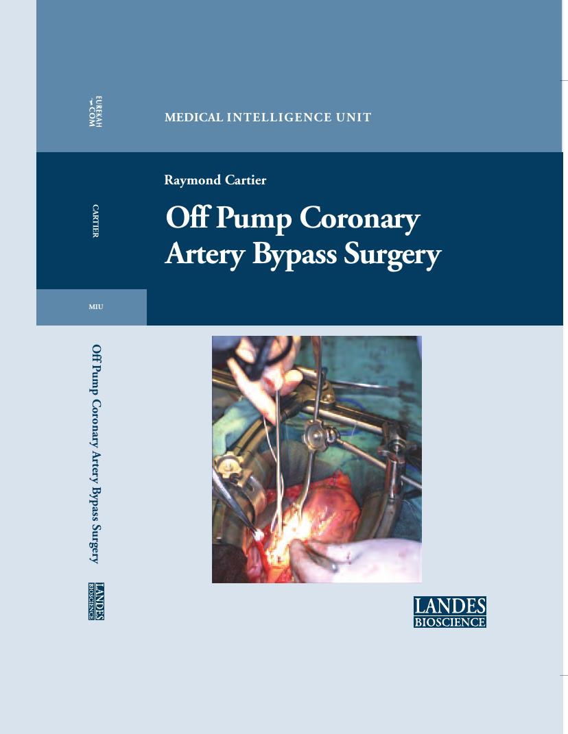 Off Pump Coronary Artery Bypass Surgery by Raymond Cartier