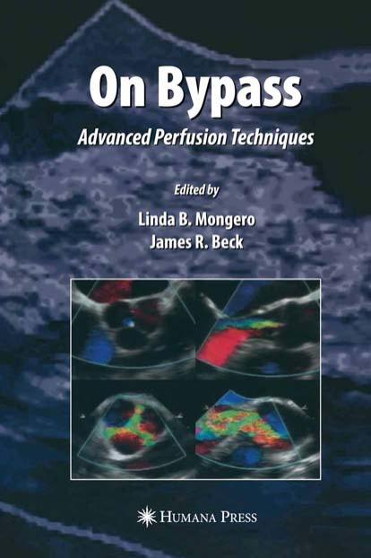 On Bypass: Advanced Perfusion Techniques (Current Cardiac Surgery) by Linda B. Mongero James R. Beck