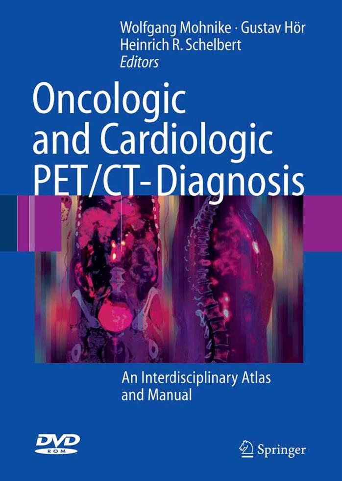 Oncologic and Cardiologic PETCT-Diagnosis: An Interdisciplinary Atlas and Manual by Wolfgang Mohnike Gustav Hör Heinrich R. Schelbert
