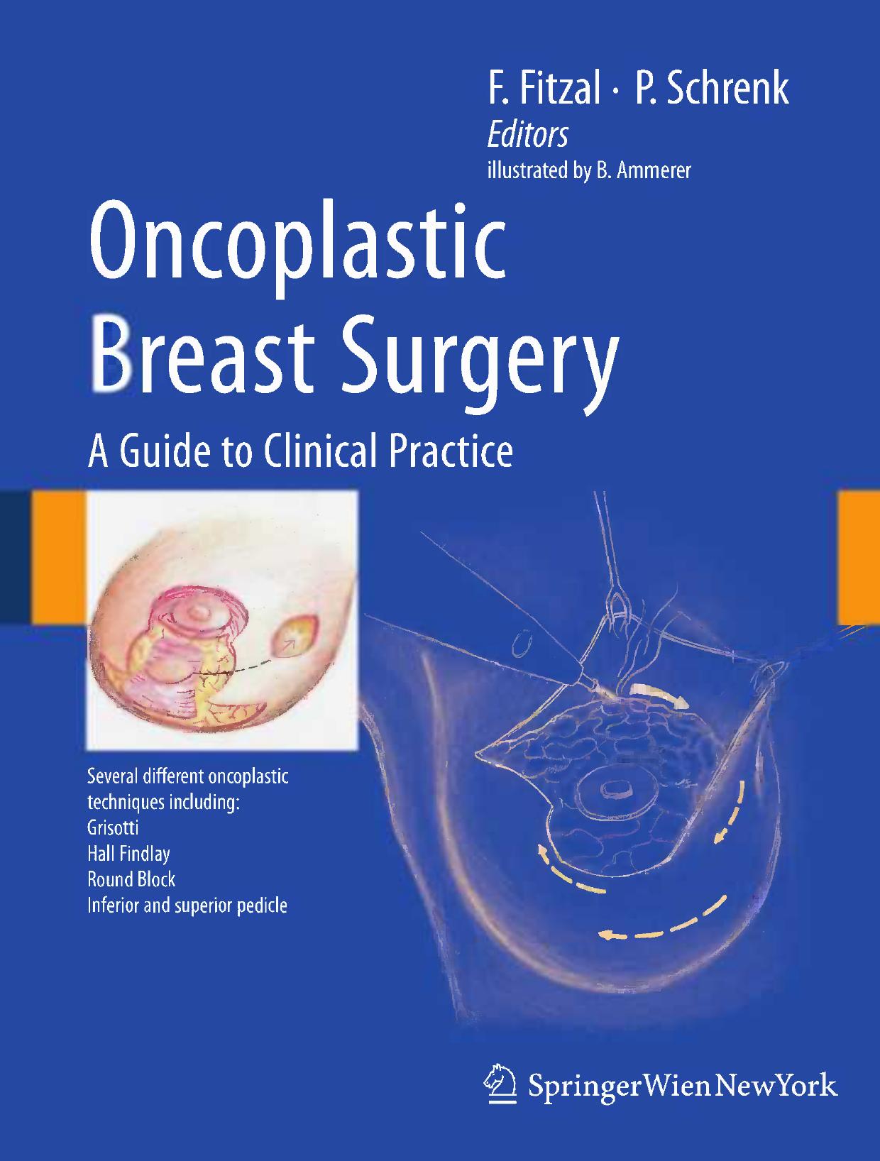 Oncoplastic Breast Surgery: A Guide to Clinical Practice by unknow