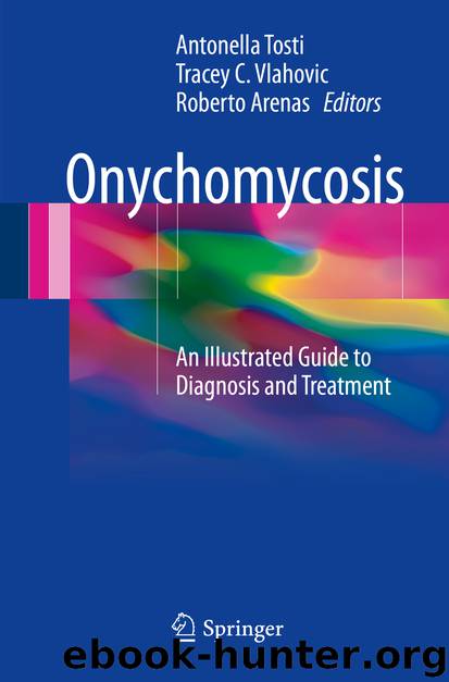 Onychomycosis by Antonella Tosti Tracey C. Vlahovic & Roberto Arenas