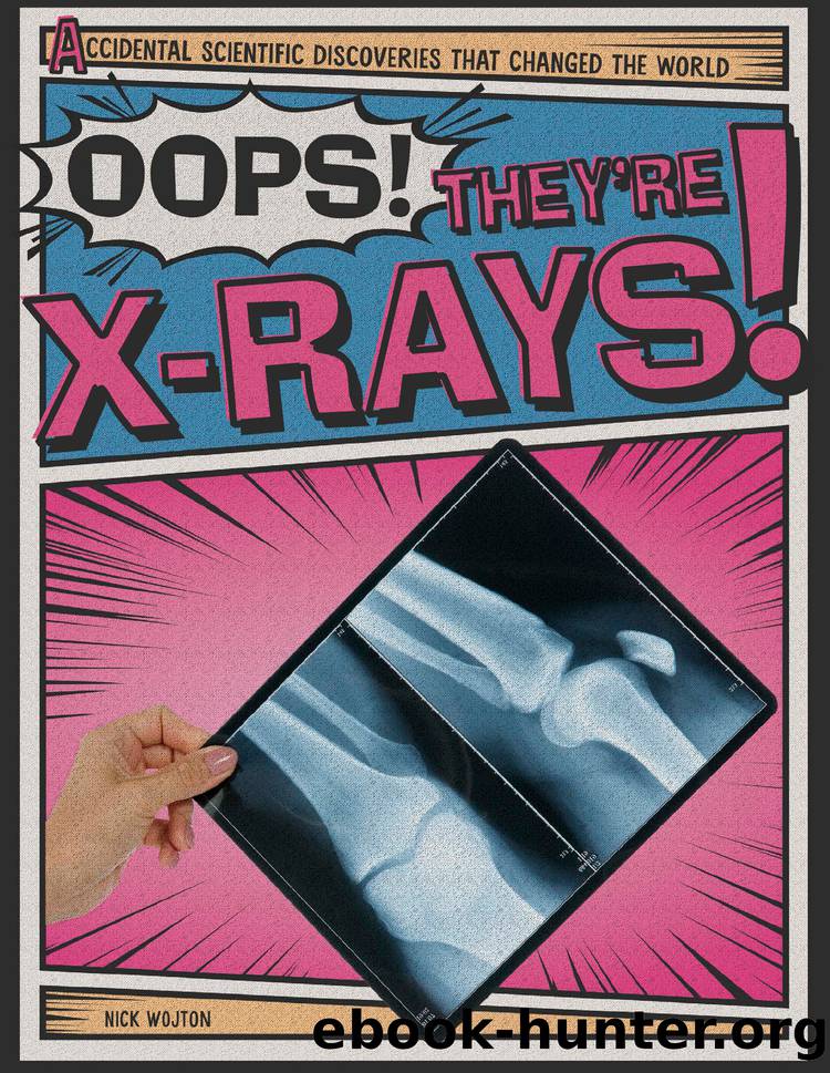 Oops! They're X-Rays! by Nick Wojtan