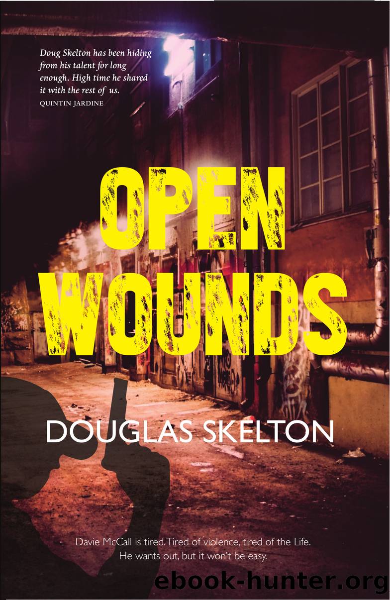Open Wounds by Douglas Skelton