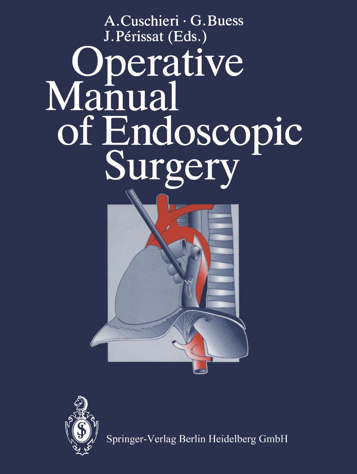 Operative Manual of Endoscopic Surgery by A. Cuschieri G. Buess (auth.) A. Cuschieri MD G. Buess MD J. Périssat MD (eds.)