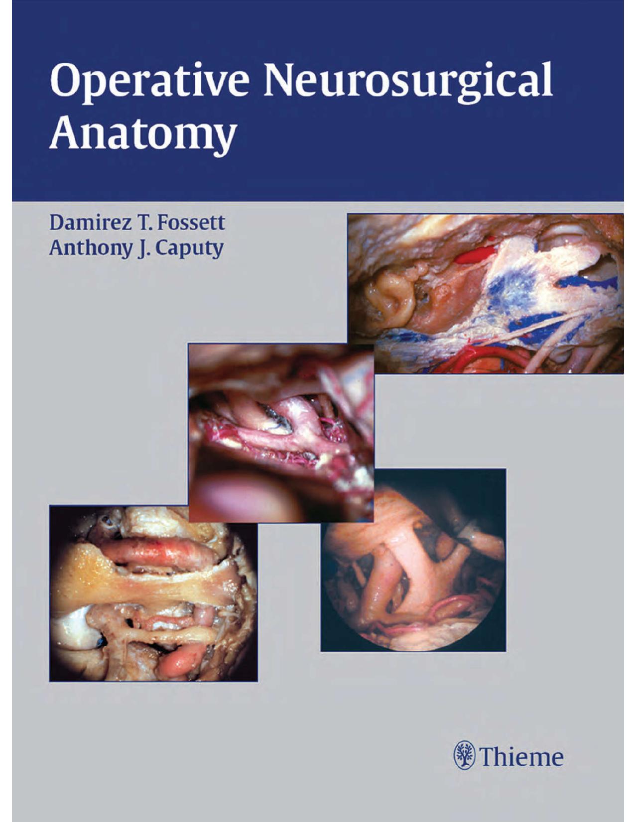 Operative Neurosurgical Anatomy by Unknow