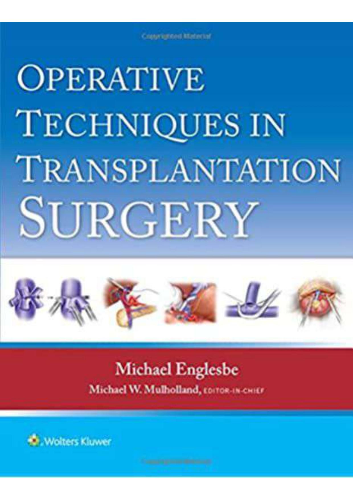 Operative Techniques in Transplantation Surgery by Michael Englesbe