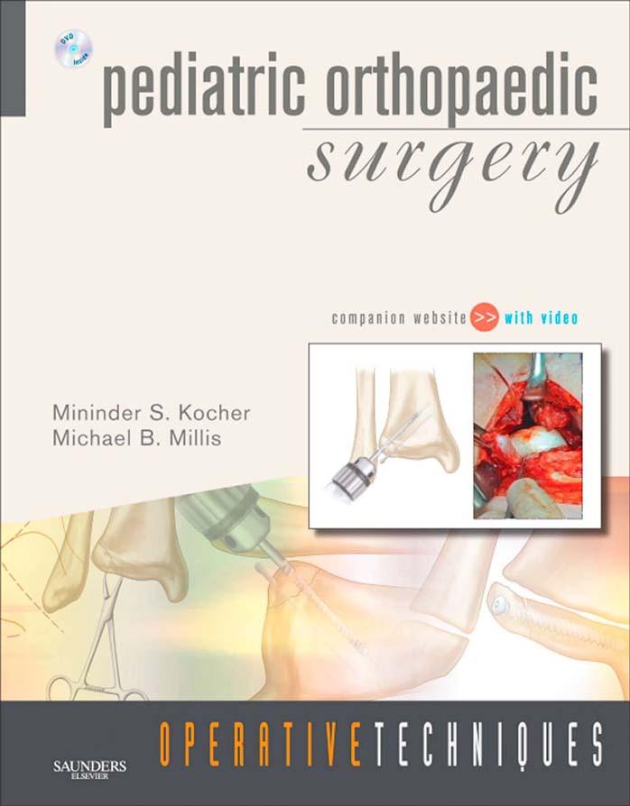 Operative Techniques: Pediatric Orthopaedic Surgery by Mininder Kocher Michael B. Millis