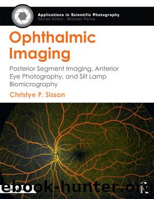 Ophthalmic Imaging by Christye P. Sisson