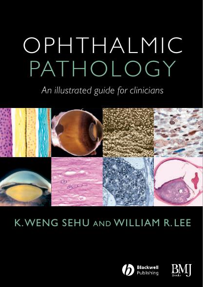 Ophthalmic Pathology: An Illustrated Guide for Clinicians by K. Weng Sehu William R. Lee