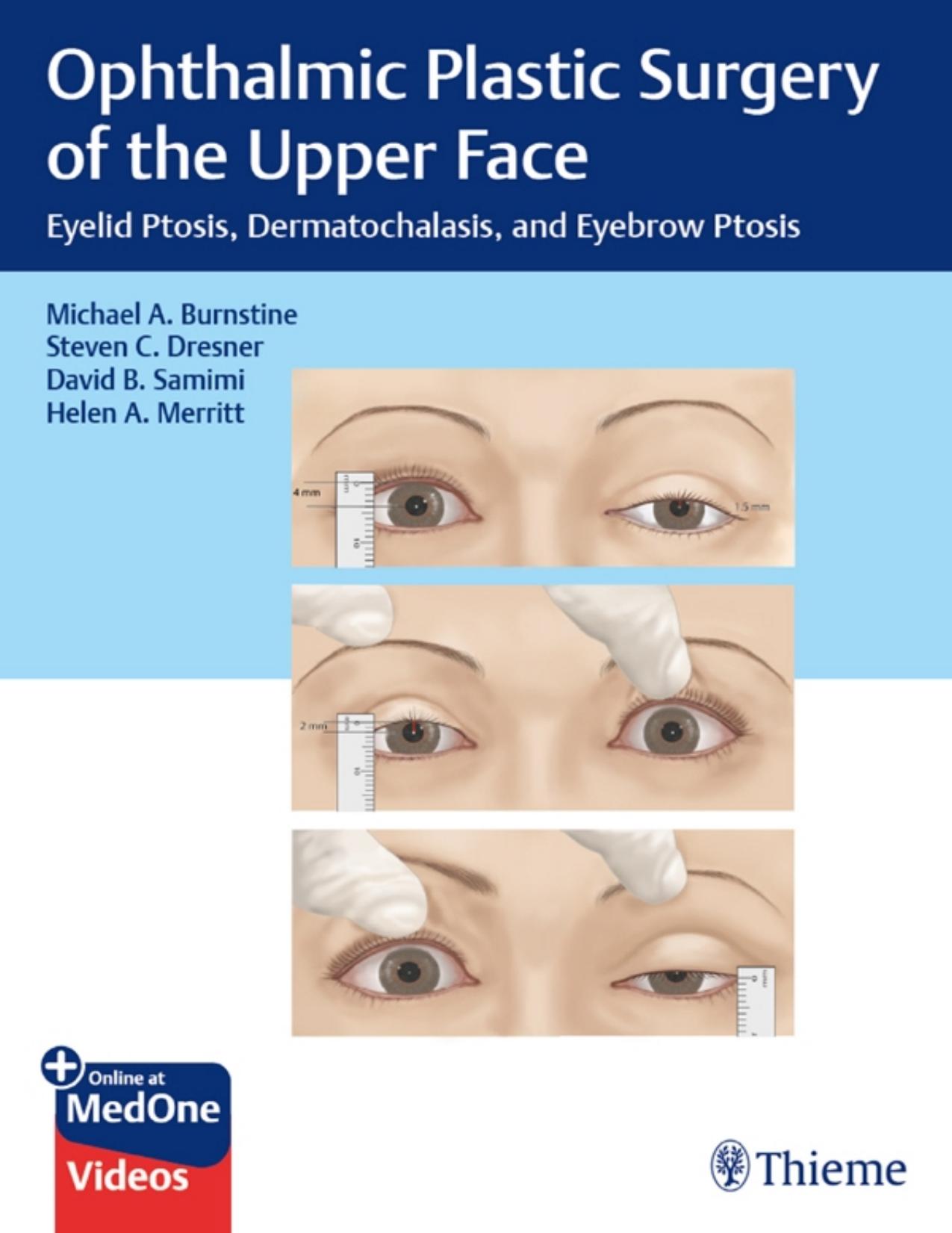 Ophthalmic Plastic Surgery of the Upper Face: Eyelid Ptosis, Dermatochalasis, and Eyebrow Ptosis by Michael Burnstine Steven Dresner David Samimi Helen Merritt