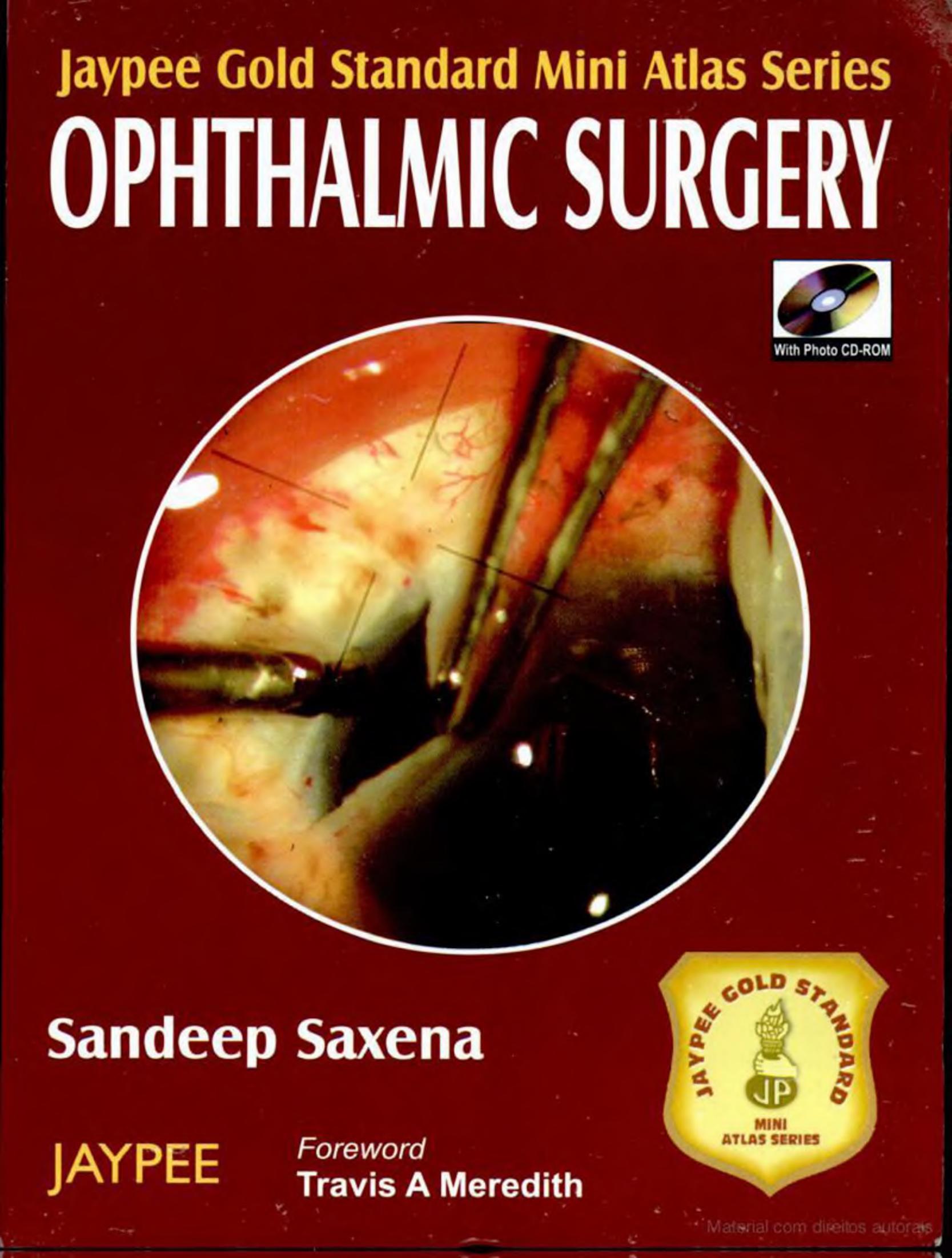 Ophthalmic Surgery by By Sandeep Saxena