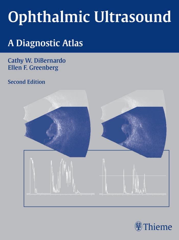 Ophthalmic Ultrasound: A Diagnostic Atlas by Unknow