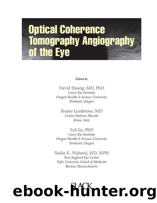 Optical Coherence Tomography Angiography of the Eye by Huang David;Lumbroso Bruno; & Bruno Lumbroso & Yali Jia & Nadia K. Waheed