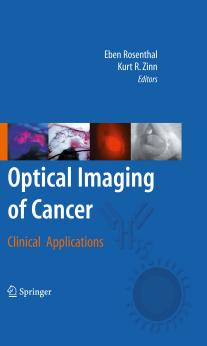 Optical Imaging of Cancer: Clinical Applications by Kent T. Keyser Christianne E. Strang (auth.) Eben Rosenthal Kurt R. Zinn (eds.)