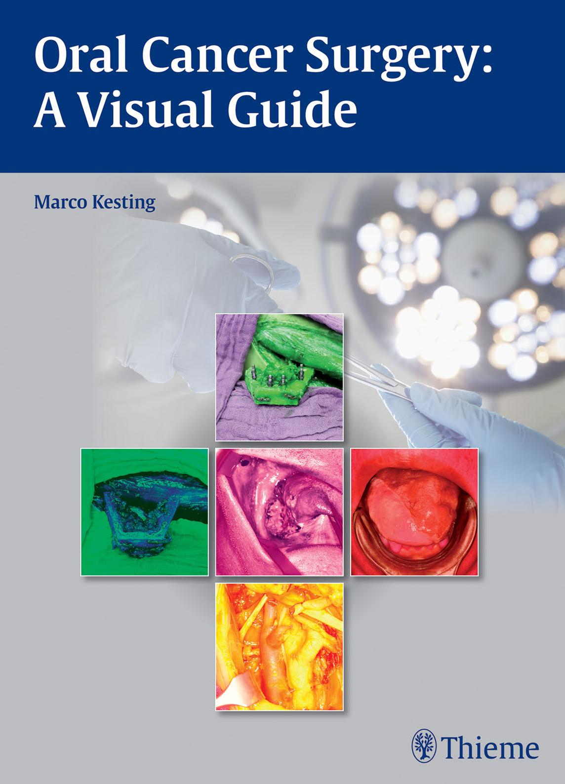 Oral Cancer Surgery: A Visual Guide by Marco R. Kesting