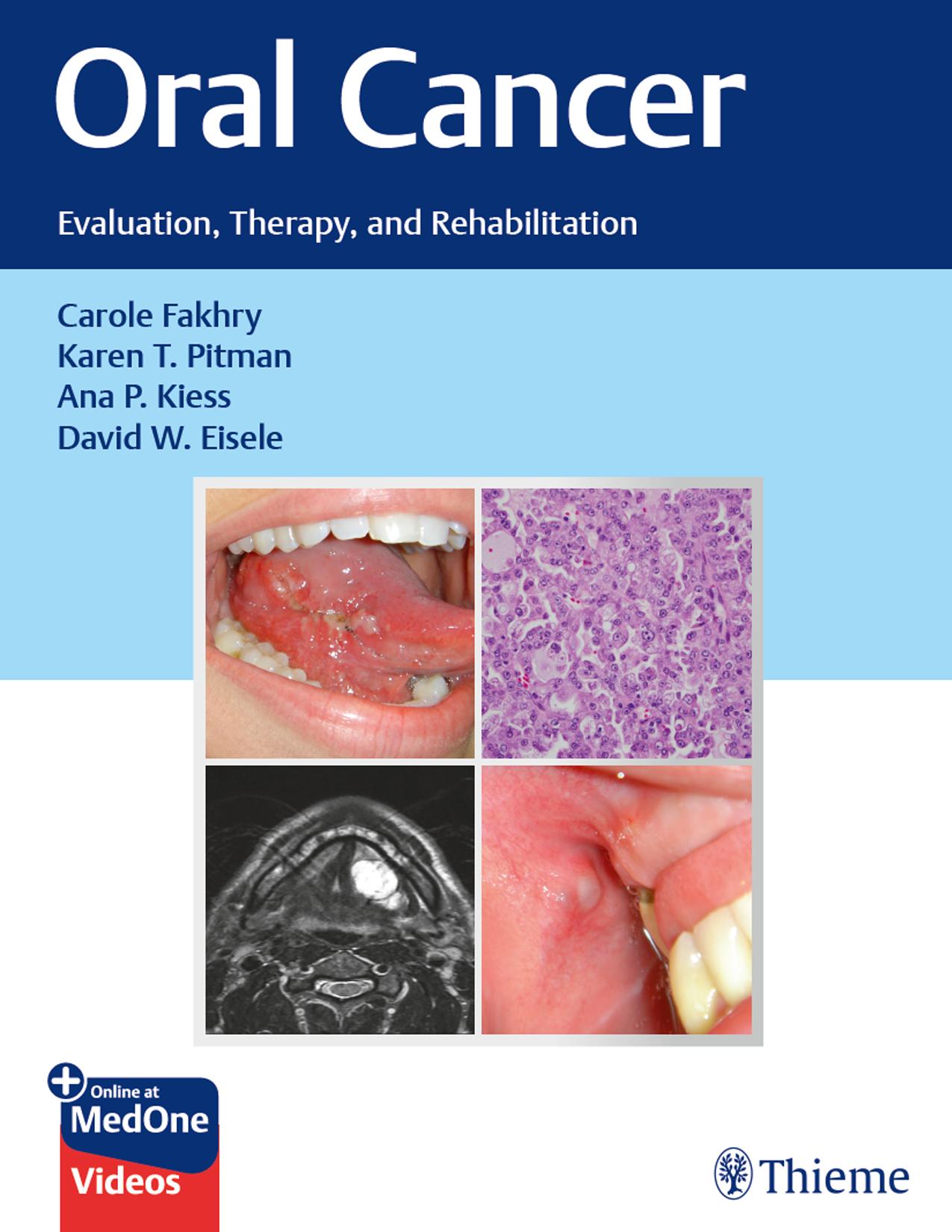 Oral Cancer: Evaluation, Therapy, and Rehabilitation by Carole Fakhry Karen Pitman Ana Kiess David Eisele
