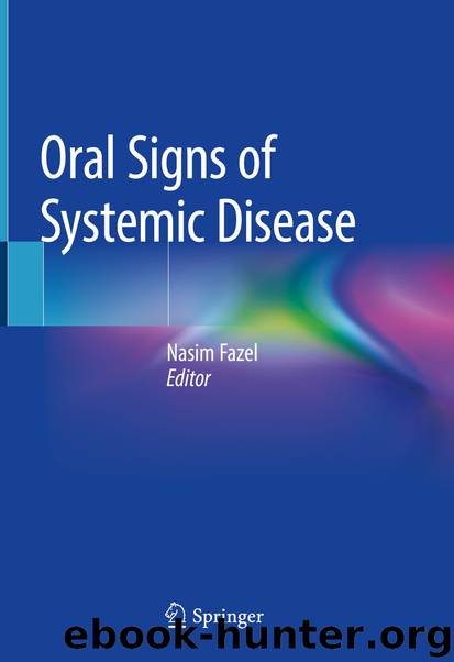 Oral Signs of Systemic Disease by Unknown