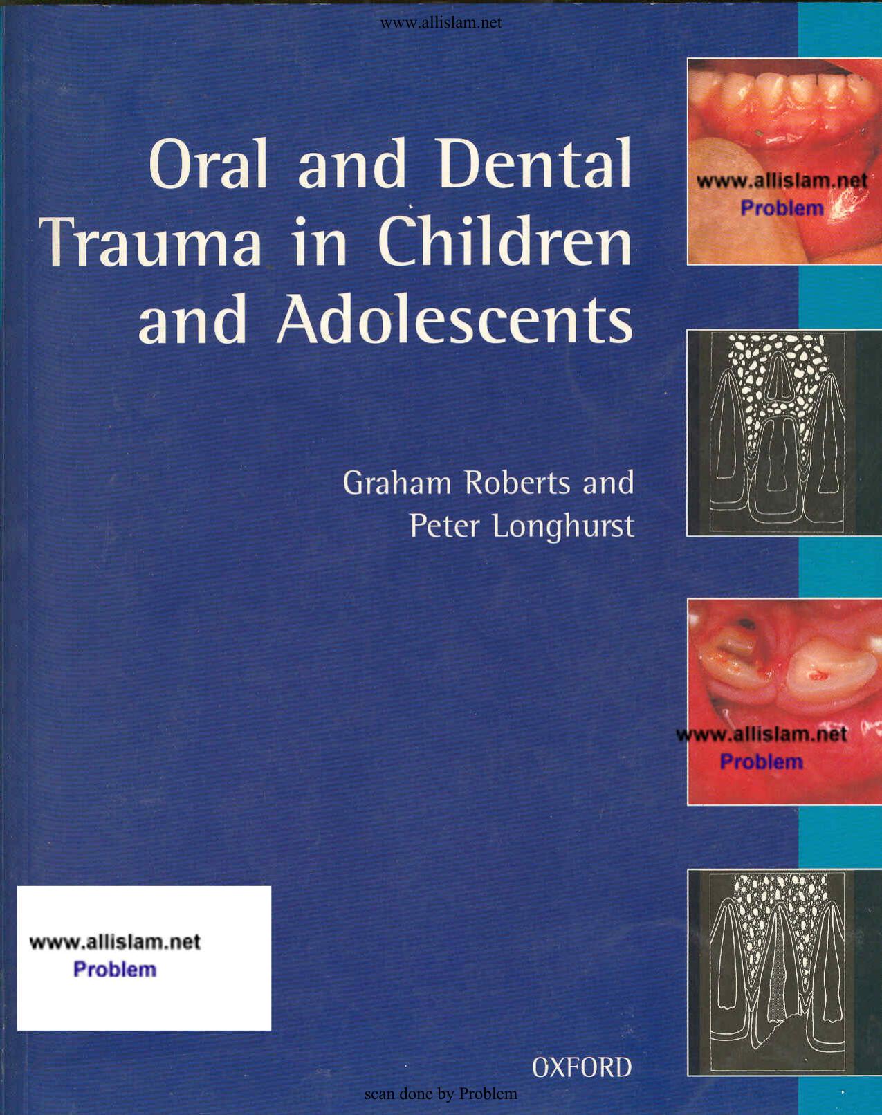 Oral and Dental Trauma in Children and Adolescents by Unknown