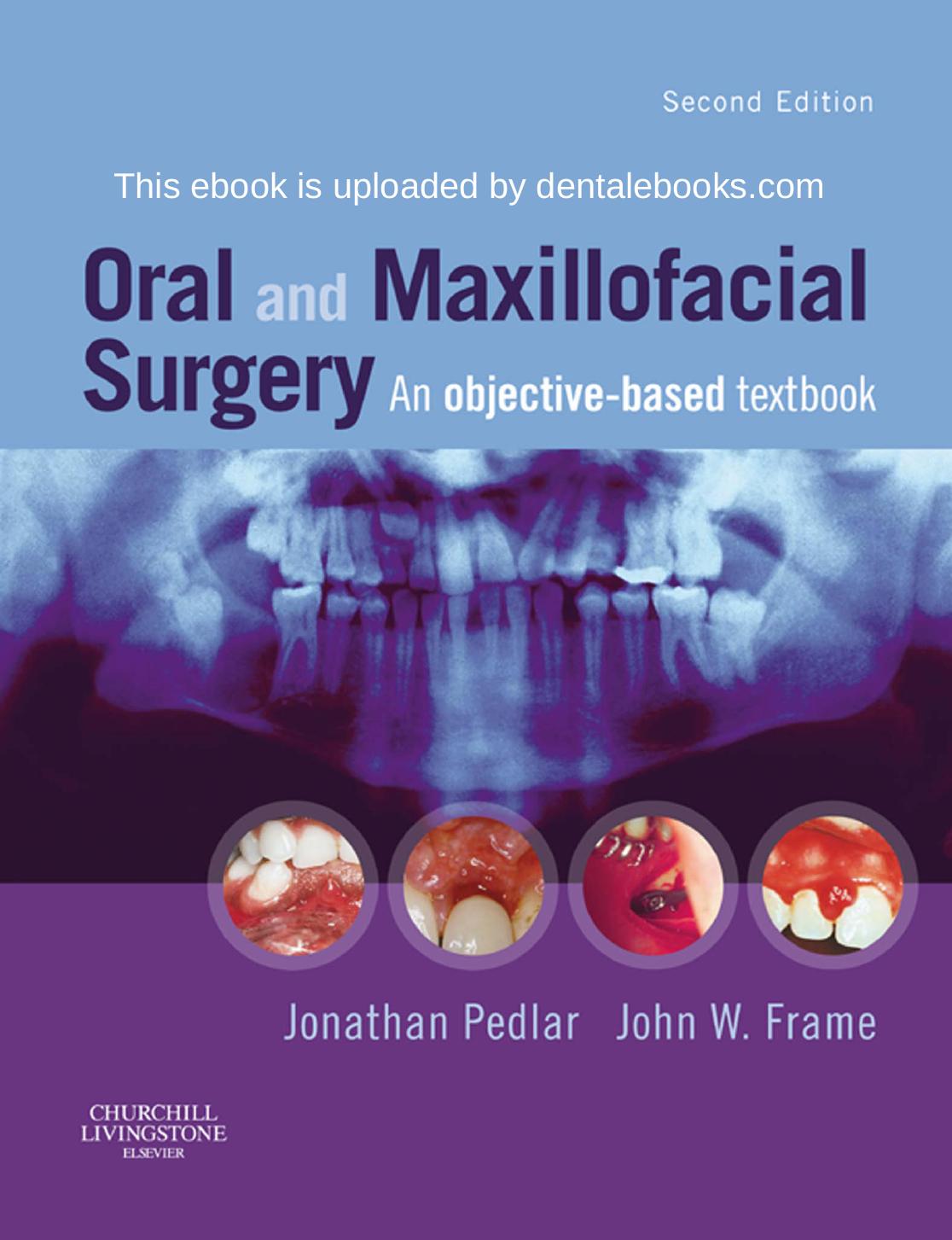 Oral and Maxillofacial Surgery E-Book by Churchill Livingstone; 2 edition (October 10 2007)