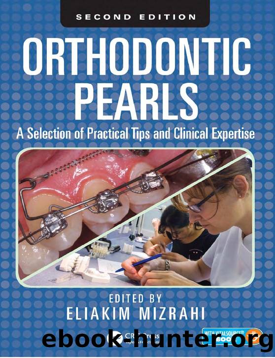 Orthodontic Pearls - A Selection of Practical Tips and Clinical Expertise, Second Edition by Eliakim Mizrahi (Editor)