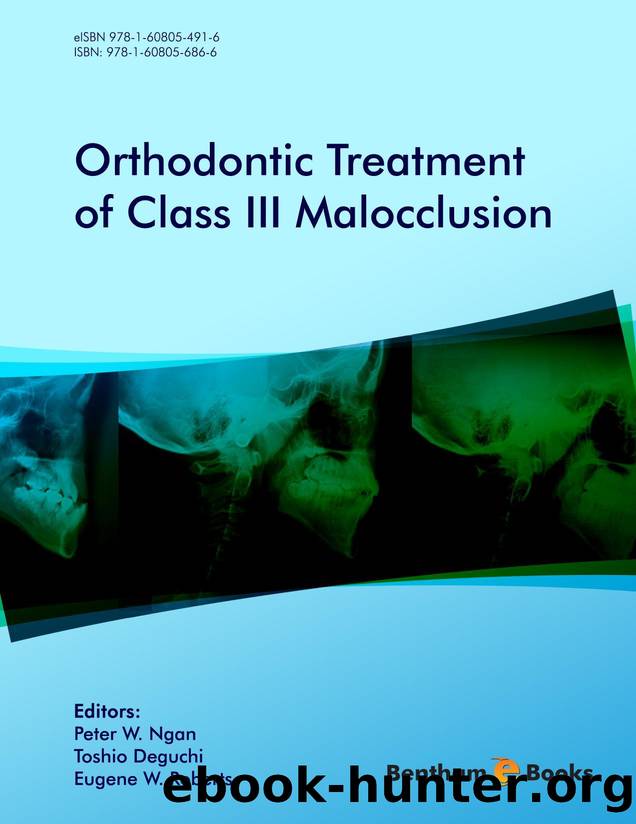 Orthodontic Treatment of Class III Malocclusion by Peter W. Ngan; Toshio Deguchi; Eugene W. Roberts