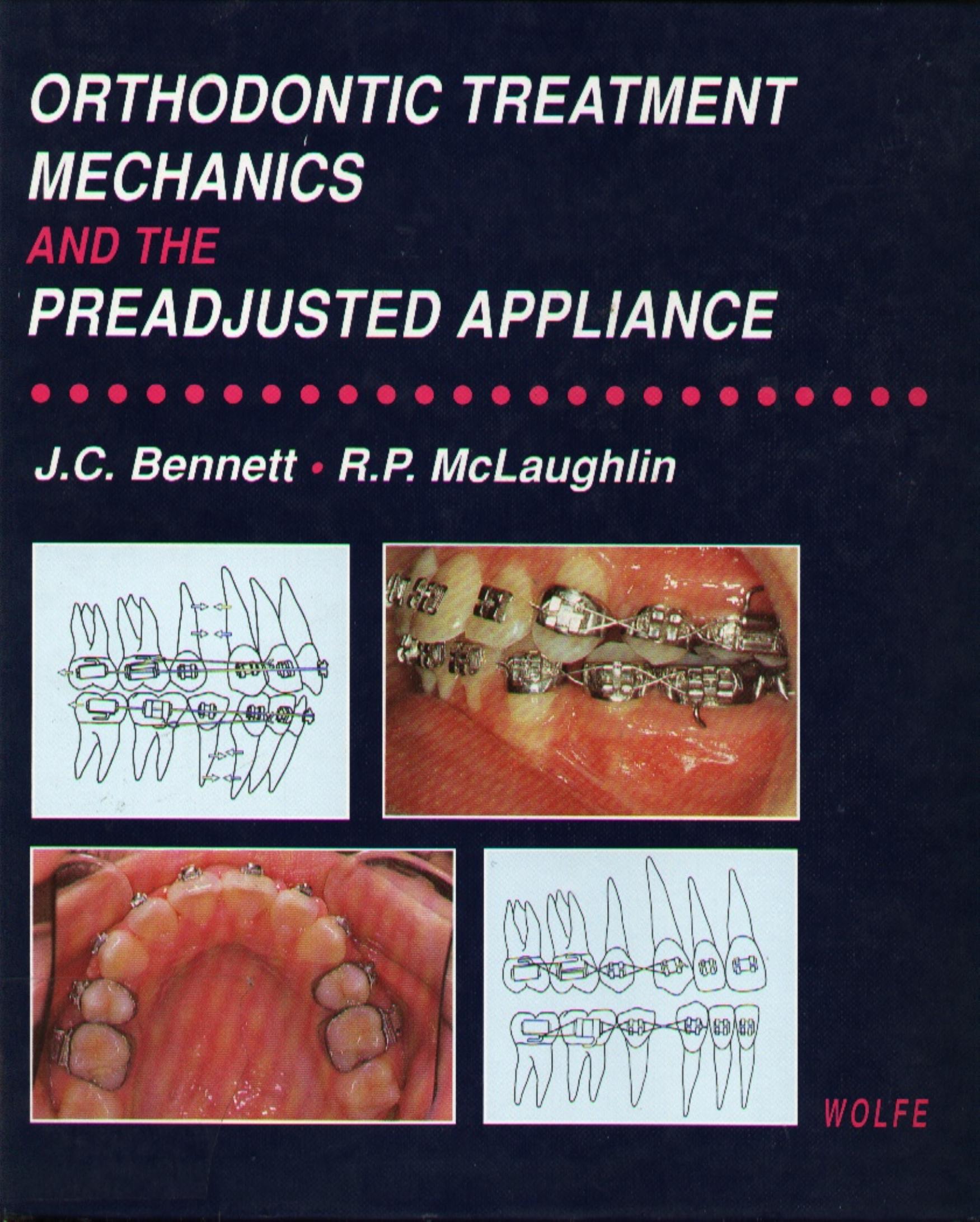 Orthodontic treatment mechanics and the preadjusted appliance by John C. Bennett Richard P. McLaughlin