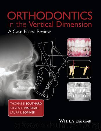 Orthodontics in the Vertical Dimension by Thomas E. Southard & Steven D. Marshall & Laura L. Bonner