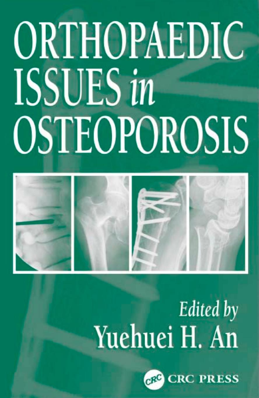 Orthopaedic Issues in Osteoporosis by Yuehuei H. An