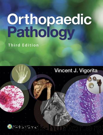 Orthopaedic Pathology by Vincent J. Vigorita