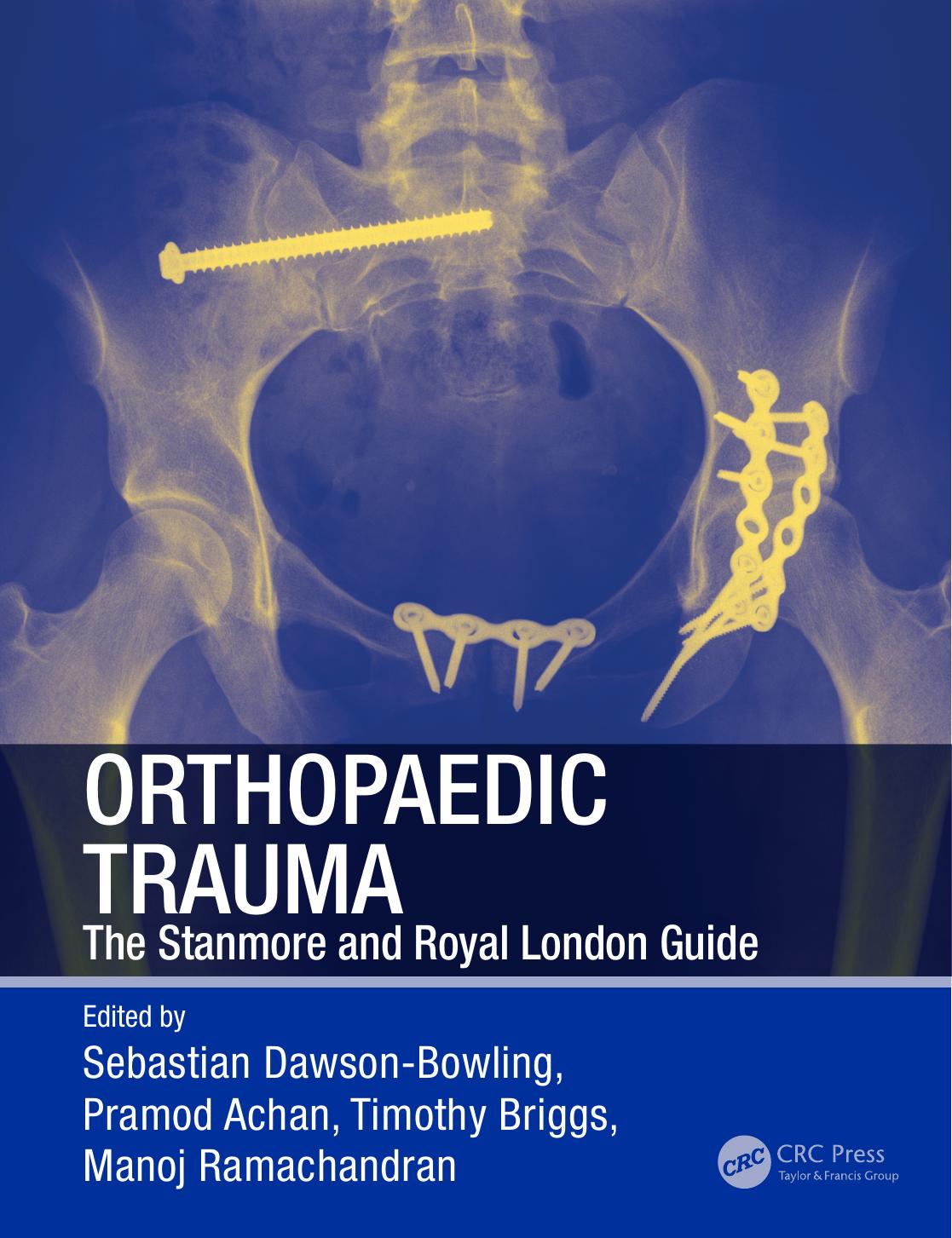 Orthopaedic Trauma: The Stanmore and Royal London Guide by Achan Pramod; Briggs Timothy; Dawson-Bowling Sebastian; Ramachandran Manoj