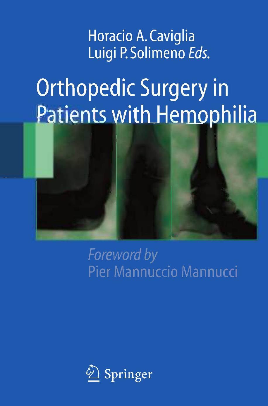 Orthopedic Surgery in Patients with Hemophilia by Michael Heim (auth.) Horacio A. Caviglia Luigi Piero Solimeno (eds.)